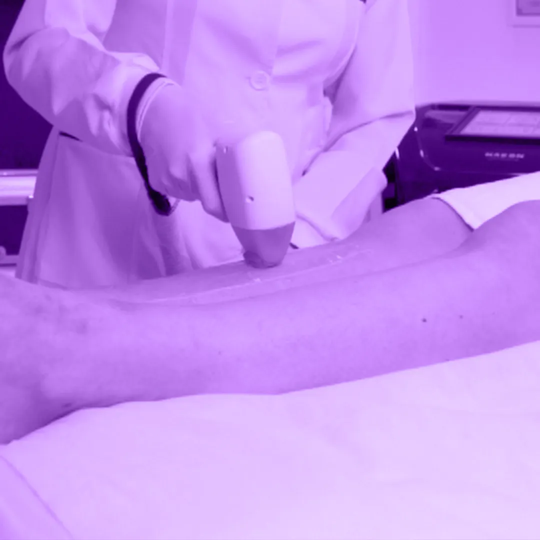 Cliente depilando as pernas com laser de epilação